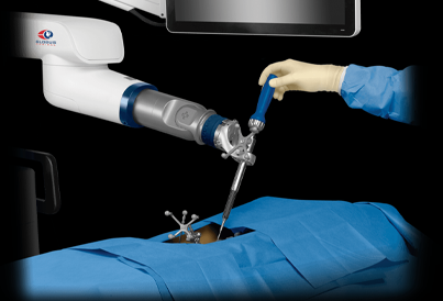 Endoscopic Spine Surgery Treatment in Chennai